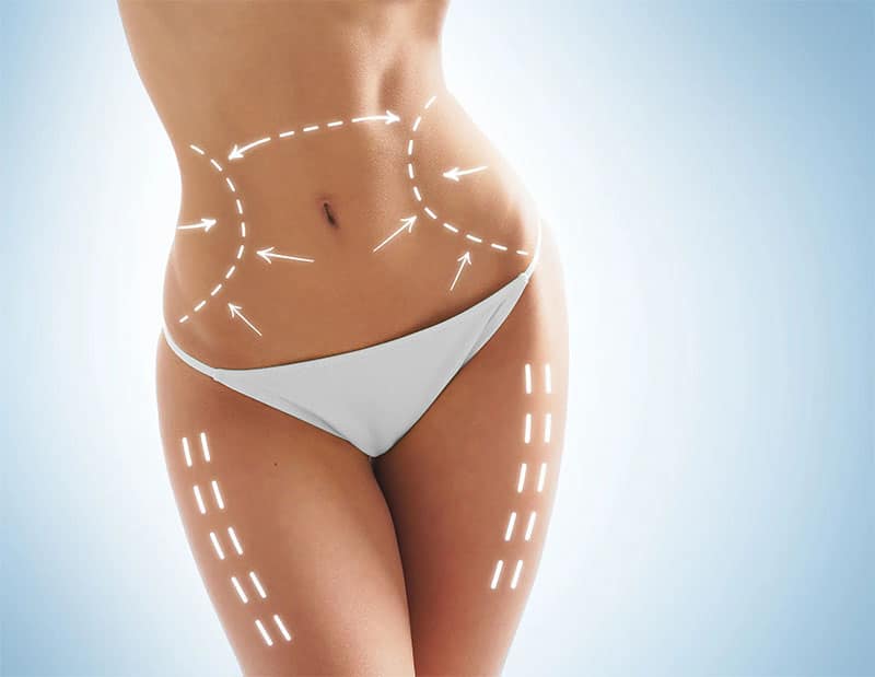 Body contouring services in Murrieta