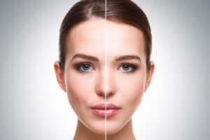 BB Glow Services in Murrieta